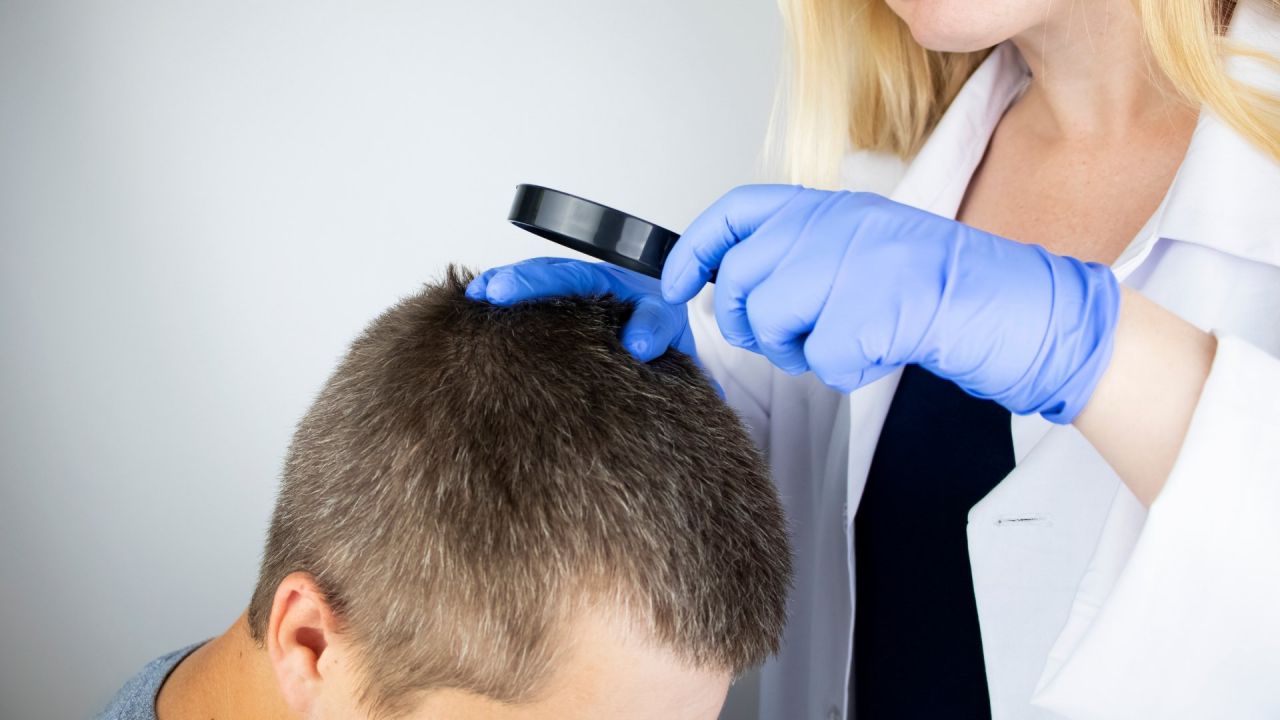 alopecia-androgenetica-diagnosi-e-cura-video